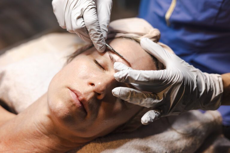 Dermaplaning Spa La La 768x512 1