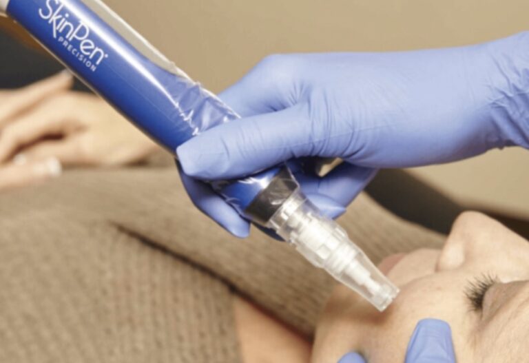 SkinPen Microneedling treatment in Austin at Spa La La Aesthetics & Wellness