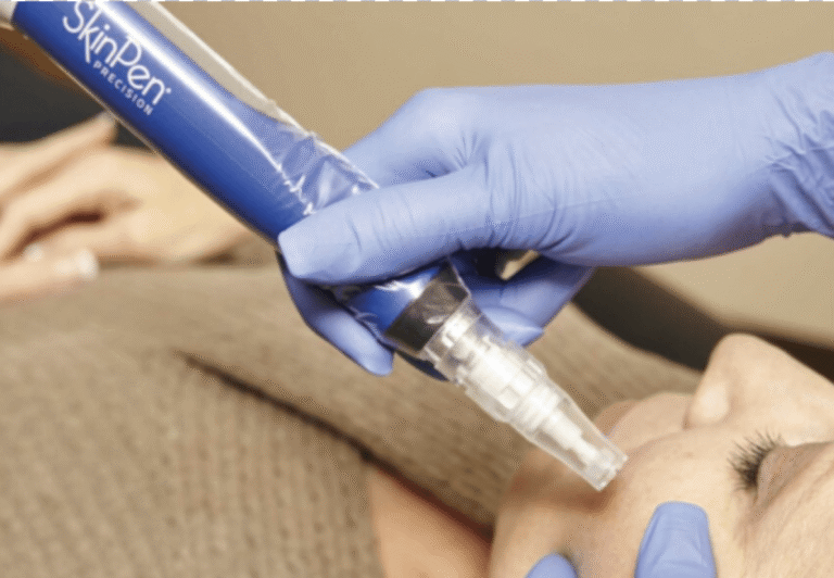 SkinPen Microneedling treatment in Austin at Spa La La Aesthetics & Wellness